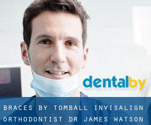 Braces by Tomball Invisalign Orthodontist Dr. James Watson