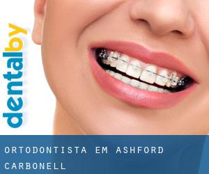 Ortodontista em Ashford Carbonell