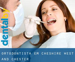 Ortodontista em Cheshire West and Chester