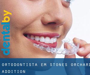 Ortodontista em Stones Orchard Addition