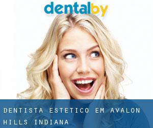 Dentista estético em Avalon Hills (Indiana)