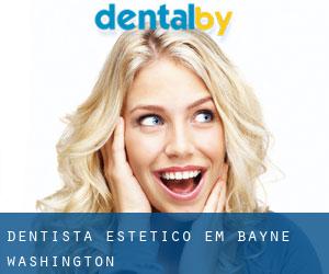 Dentista estético em Bayne (Washington)