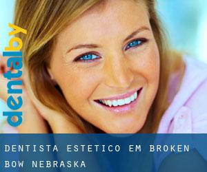 Dentista estético em Broken Bow (Nebraska)