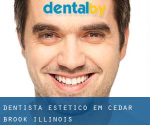 Dentista estético em Cedar Brook (Illinois)
