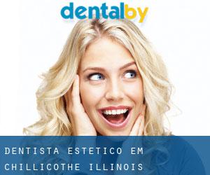 Dentista estético em Chillicothe (Illinois)