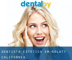 Dentista estético em Gelatt (California)