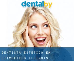 Dentista estético em Litchfield (Illinois)