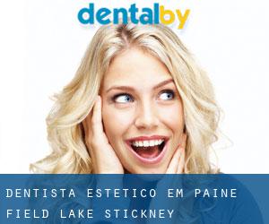 Dentista estético em Paine Field-Lake Stickney