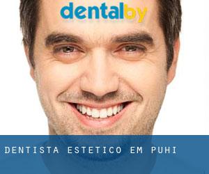 Dentista estético em Puhi