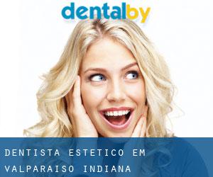 Dentista estético em Valparaiso (Indiana)