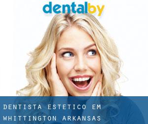 Dentista estético em Whittington (Arkansas)
