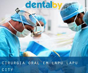 Cirurgia oral em Lapu-Lapu City