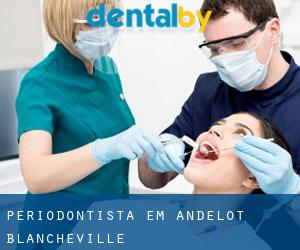 Periodontista em Andelot-Blancheville