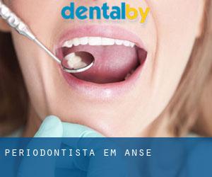 Periodontista em Anse