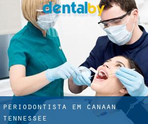 Periodontista em Canaan (Tennessee)