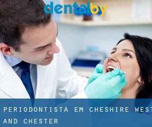 Periodontista em Cheshire West and Chester