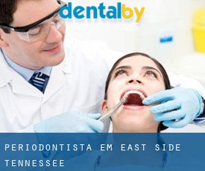 Periodontista em East Side (Tennessee)