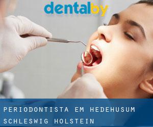 Periodontista em Hedehusum (Schleswig-Holstein)