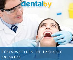 Periodontista em Lakeside (Colorado)