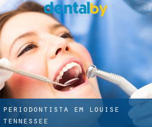 Periodontista em Louise (Tennessee)