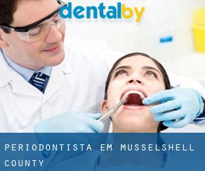 Periodontista em Musselshell County