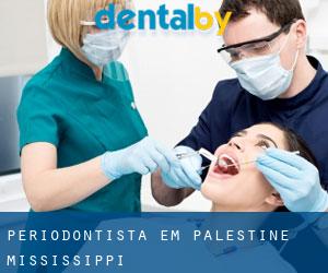 Periodontista em Palestine (Mississippi)