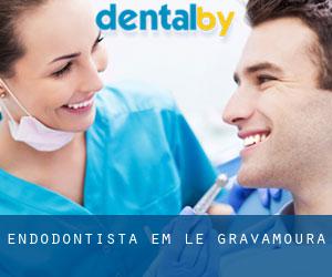 Endodontista em Le Gravamoura