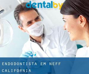 Endodontista em Neff (California)