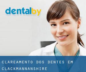 Clareamento dos dentes em Clackmannanshire