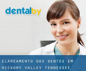 Clareamento dos dentes em Hickory Valley (Tennessee)