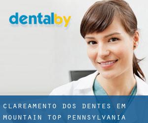 Clareamento dos dentes em Mountain Top (Pennsylvania)