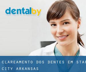 Clareamento dos dentes em Star City (Arkansas)