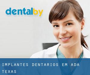 Implantes dentários em Ada (Texas)