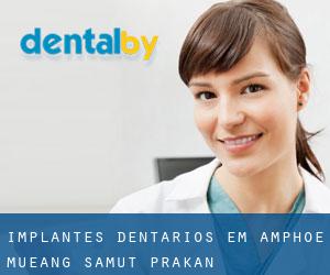 Implantes dentários em Amphoe Mueang Samut Prakan