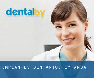 Implantes dentários em Anda