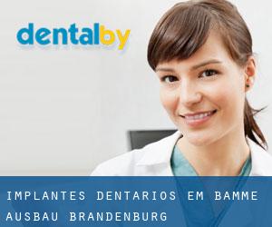 Implantes dentários em Bamme Ausbau (Brandenburg)