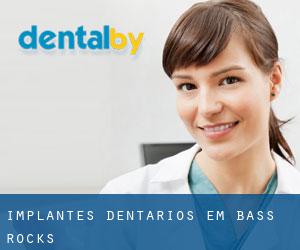 Implantes dentários em Bass Rocks