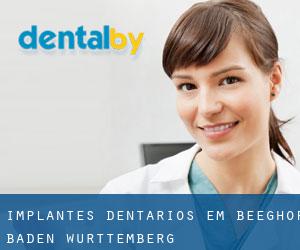 Implantes dentários em Beeghof (Baden-Württemberg)