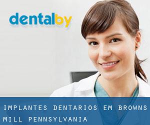 Implantes dentários em Browns Mill (Pennsylvania)