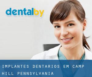 Implantes dentários em Camp Hill (Pennsylvania)