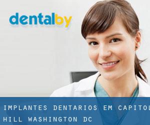Implantes dentários em Capitol Hill (Washington, D.C.)