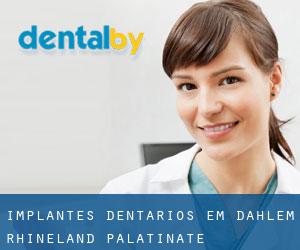 Implantes dentários em Dahlem (Rhineland-Palatinate) Implantes dentários em Dahlem (Rhineland-Palatinate)