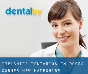Implantes dentários em Dorrs Corner (New Hampshire)