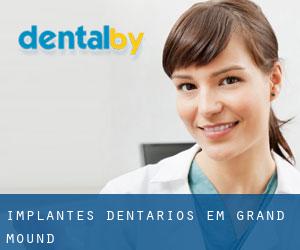 Implantes dentários em Grand Mound