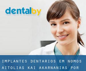 Implantes dentários em Nomós Aitolías kai Akarnanías por cidade importante - página 1
