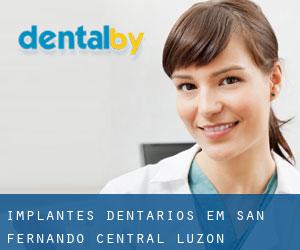 Implantes dentários em San Fernando (Central Luzon)