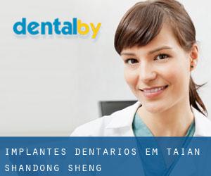 Implantes dentários em Tai'an (Shandong Sheng) Implantes dentários em Tai'an (Shandong Sheng)