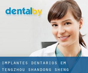 Implantes dentários em Tengzhou (Shandong Sheng)