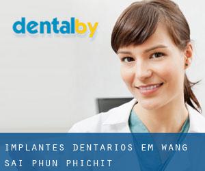 Implantes dentários em Wang Sai Phun (Phichit)