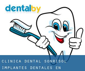 Clinica Dental Sonrisol. Implantes Dentales en Torremolinos